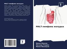 Bookcover of MALT-лимфома желудка