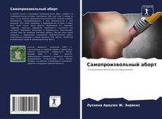 Bookcover of Самопроизвольный аборт