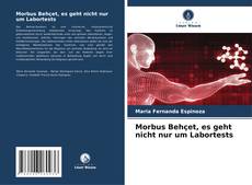 Buchcover von Morbus Behçet, es geht nicht nur um Labortests