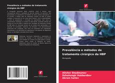 Bookcover of Prevalência e métodos de tratamento cirúrgico da HBP