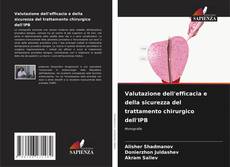 Copertina di Valutazione dell'efficacia e della sicurezza del trattamento chirurgico dell'IPB