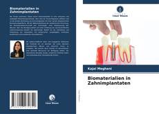 Capa do livro de Biomaterialien in Zahnimplantaten 