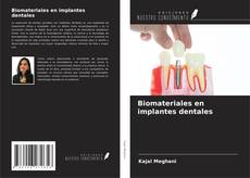 Biomateriales en implantes dentales kitap kapağı