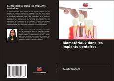 Buchcover von Biomatériaux dans les implants dentaires