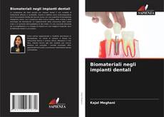 Capa do livro de Biomateriali negli impianti dentali 