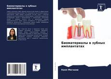 Биоматериалы в зубных имплантатах kitap kapağı