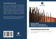 Bookcover of HAARTRANSPLANTATION