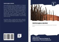 Bookcover of ПЕРЕСАДКА ВОЛОС