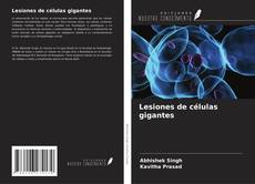 Bookcover of Lesiones de células gigantes