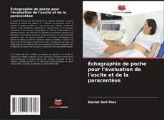 Bookcover of Échographie de poche pour l'évaluation de l'ascite et de la paracentèse
