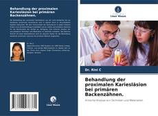 Bookcover of Behandlung der proximalen Kariesläsion bei primären Backenzähnen.