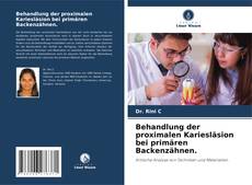 Couverture de Behandlung der proximalen Kariesläsion bei primären Backenzähnen.