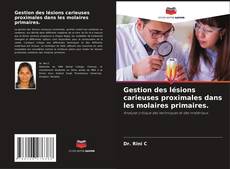 Bookcover of Gestion des lésions carieuses proximales dans les molaires primaires.