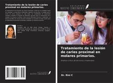Bookcover of Tratamiento de la lesión de caries proximal en molares primarios.