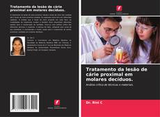 Tratamento da lesão de cárie proximal em molares decíduos.的封面
