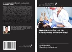Bookcover of Avances recientes en endodoncia convencional