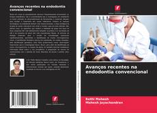Buchcover von Avanços recentes na endodontia convencional