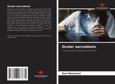 Buchcover von Ocular sarcoidosis