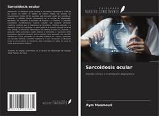 Buchcover von Sarcoidosis ocular