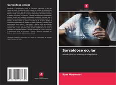 Buchcover von Sarcoidose ocular