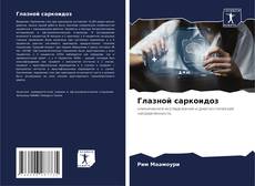 Bookcover of Глазной саркоидоз