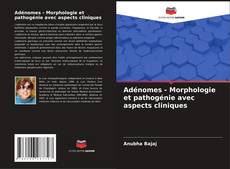 Bookcover of Adénomes - Morphologie et pathogénie avec aspects cliniques
