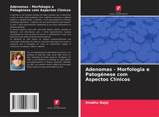 Copertina di Adenomas - Morfologia e Patogénese com Aspectos Clínicos