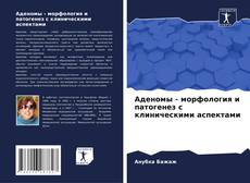Capa do livro de Аденомы - морфология и патогенез с клиническими аспектами 