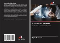 Copertina di Sarcoidosi oculare