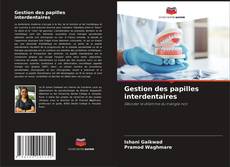 Bookcover of Gestion des papilles interdentaires