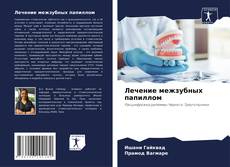 Bookcover of Лечение межзубных папиллом
