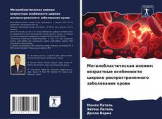 Bookcover of Мегалобластическая анемия: возрастные особенности широко распространенного заболевания крови
