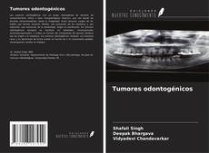 Bookcover of Tumores odontogénicos