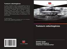 Bookcover of Tumeurs odontogènes