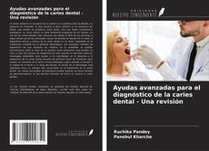Bookcover of Ayudas avanzadas para el diagnóstico de la caries dental - Una revisión