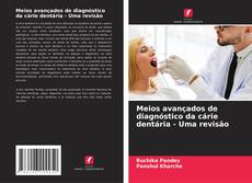 Обложка Meios avançados de diagnóstico da cárie dentária - Uma revisão