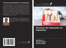 Bookcover of Técnicas de impresión en implantes