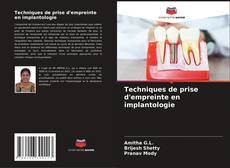 Bookcover of Techniques de prise d'empreinte en implantologie