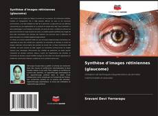 Copertina di Synthèse d'images rétiniennes (glaucome)