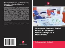 Couverture de Síndrome Femoral Facial Femoral: Achados Estomatológicos e Tratamento