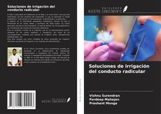 Copertina di Soluciones de irrigación del conducto radicular