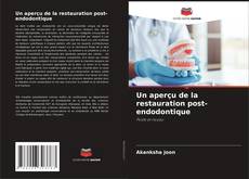 Buchcover von Un aperçu de la restauration post-endodontique