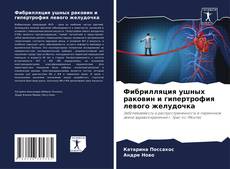 Bookcover of Фибрилляция ушных раковин и гипертрофия левого желудочка