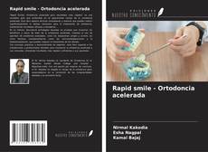 Capa do livro de Rapid smile - Ortodoncia acelerada 