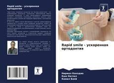 Bookcover of Rapid smile - ускоренная ортодонтия