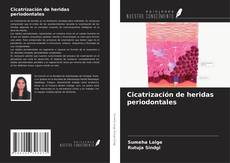 Bookcover of Cicatrización de heridas periodontales