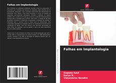 Borítókép a  Falhas em Implantologia - hoz