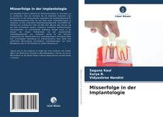 Buchcover von Misserfolge in der Implantologie