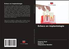 Bookcover of Échecs en implantologie