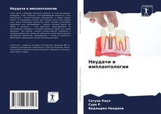 Buchcover von Неудачи в имплантологии